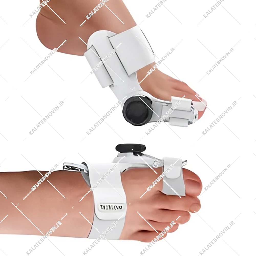 اصلاح کننده شست پا هالوکس والگوس